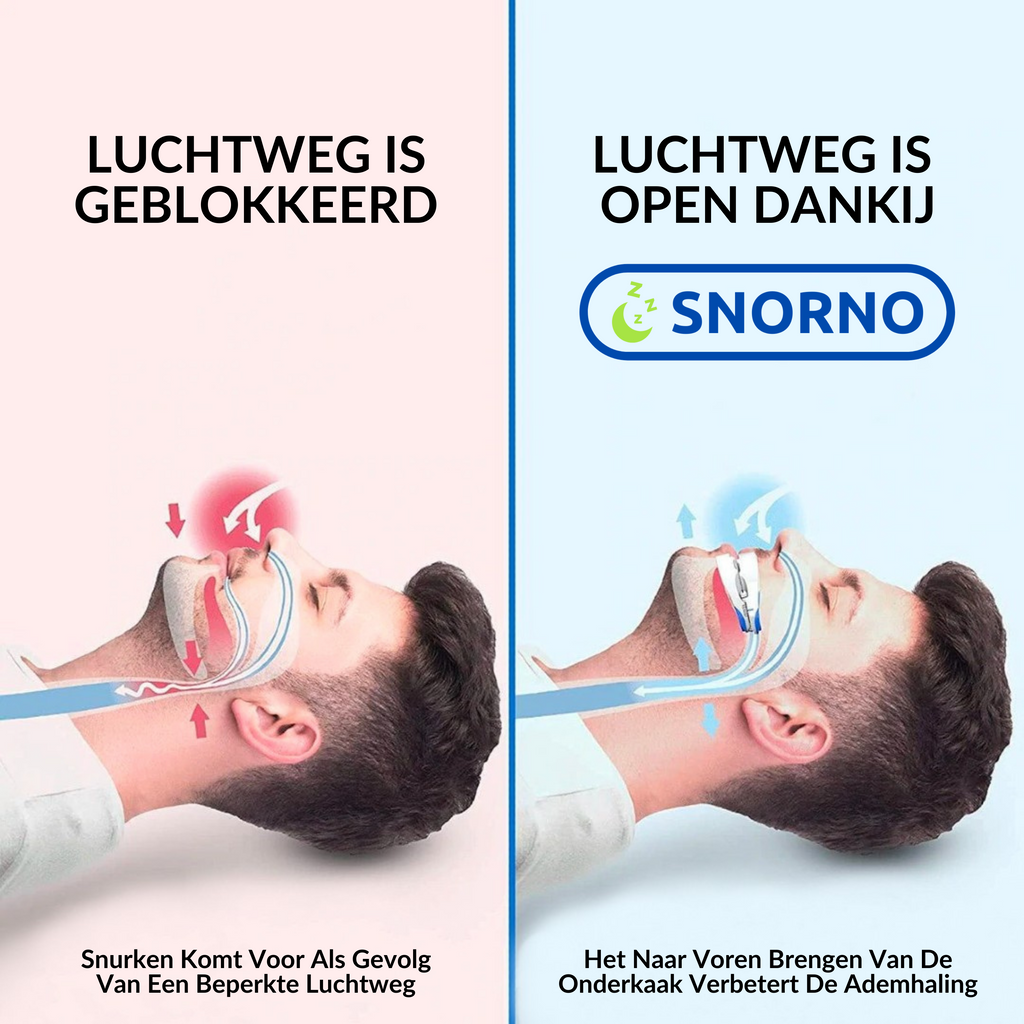 Anti-Snore Mouthpiece