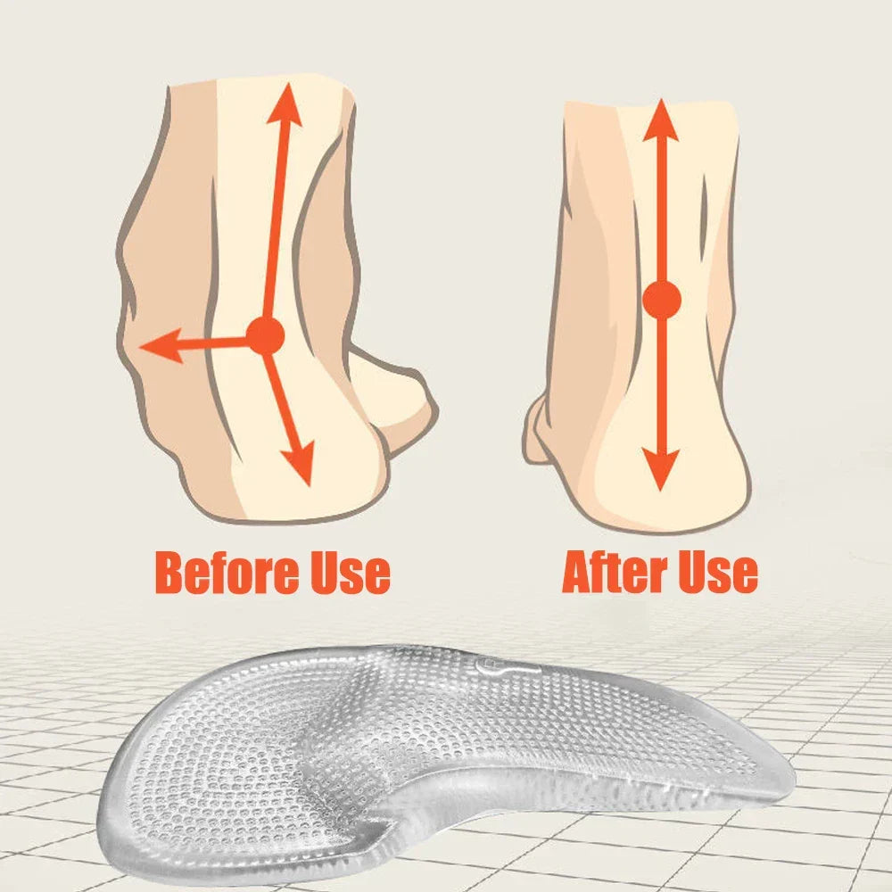 Silicone Gel Insoles